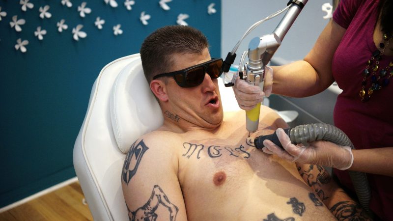 Государственная программа удаления татуировок